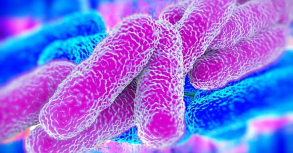 what is mlegionnaires’ disease
